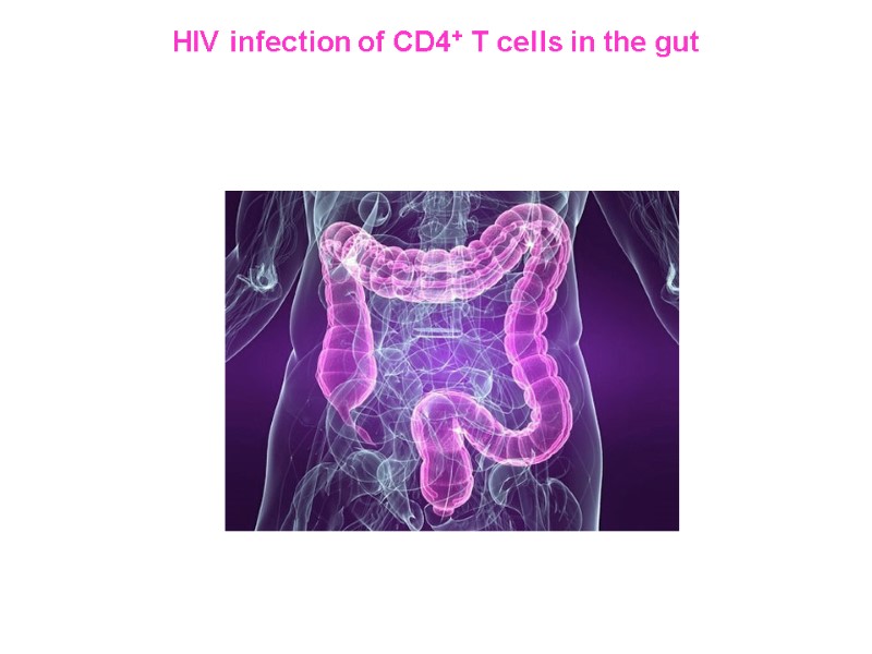 HIV infection of CD4+ T cells in the gut